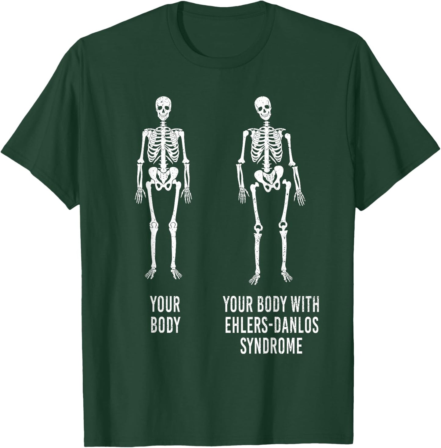 Your Body with Ehlers-Danlos Syndrome EDS Support Awareness Small T-Shirt - T-Shirt | Forest