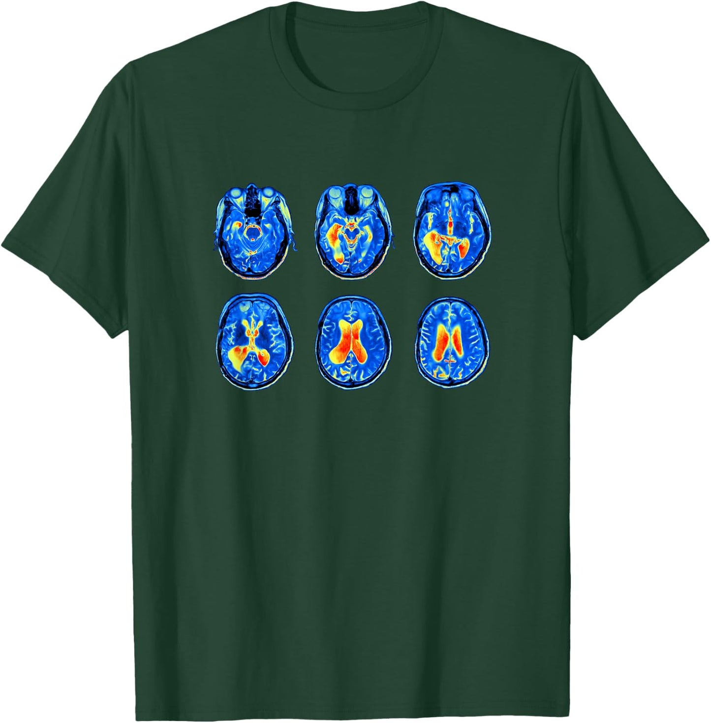 Brain Scan MRI Images of Human Brain T-Shirt - T-Shirt | Forest