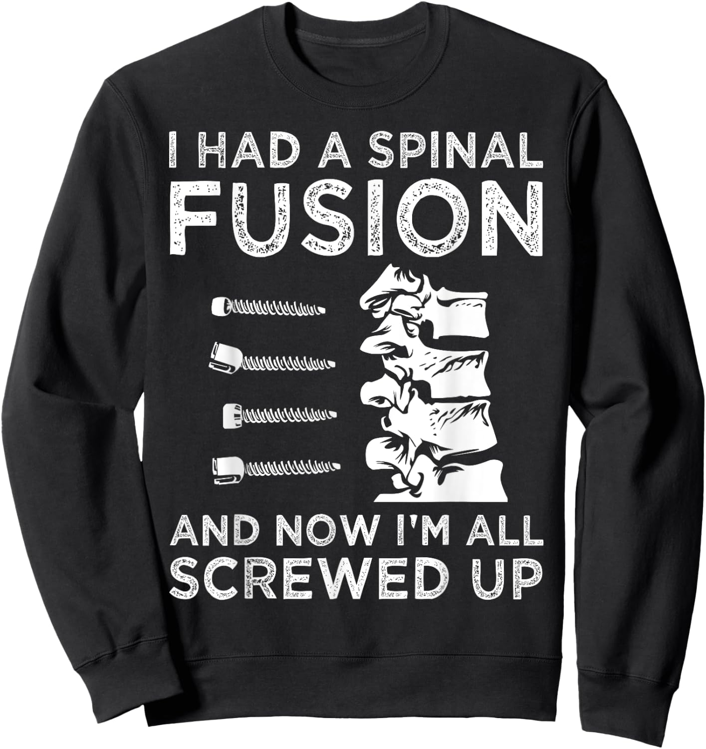 Cool Scoliosis Spinal Fusion Gift Back Surgery Recovery Gift Sweatshirt - Sweatshirt | Black
