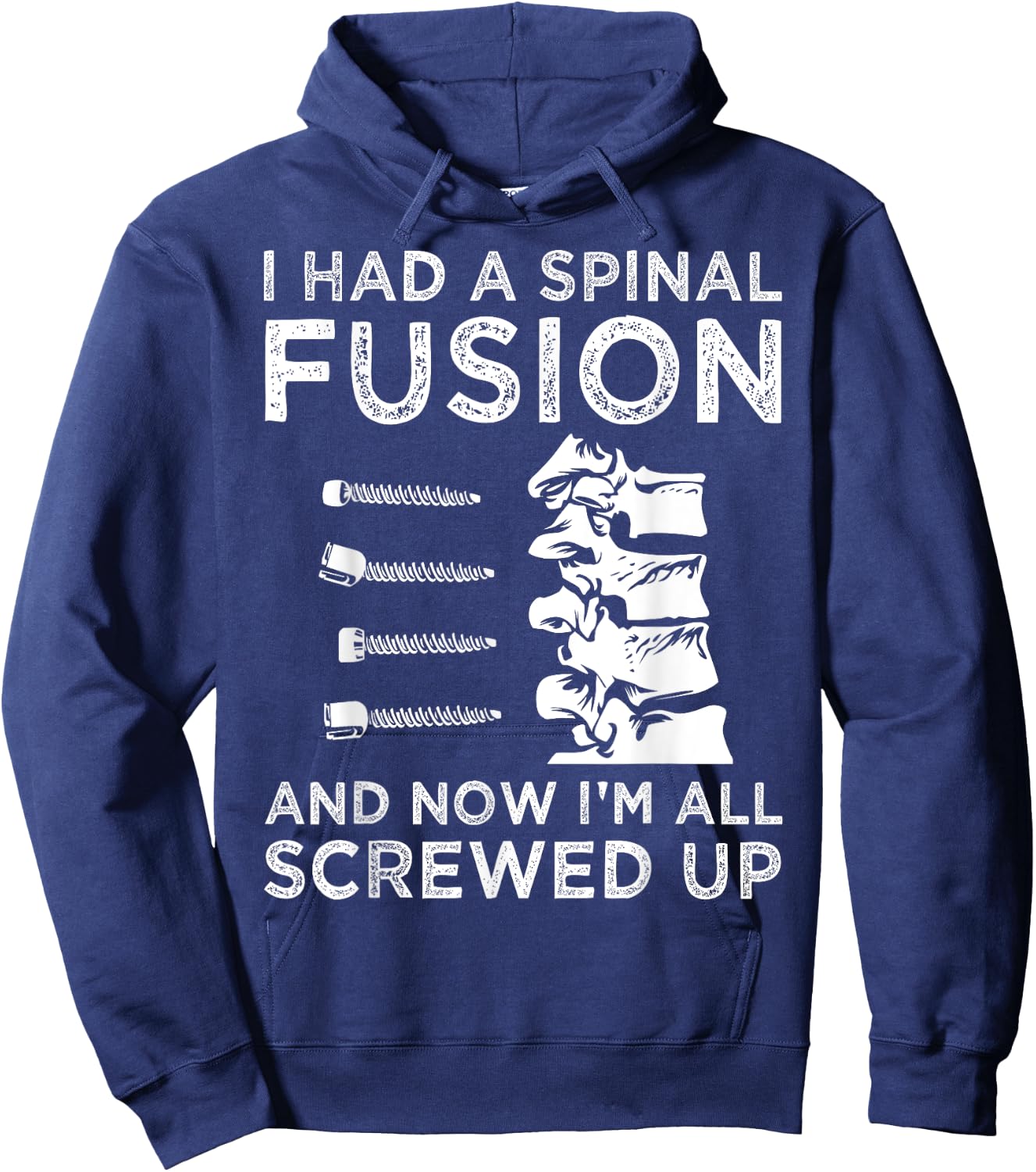 Cool Scoliosis Spinal Fusion Gift Back Surgery Recovery Gift Hoodie - Hoodie | Navy