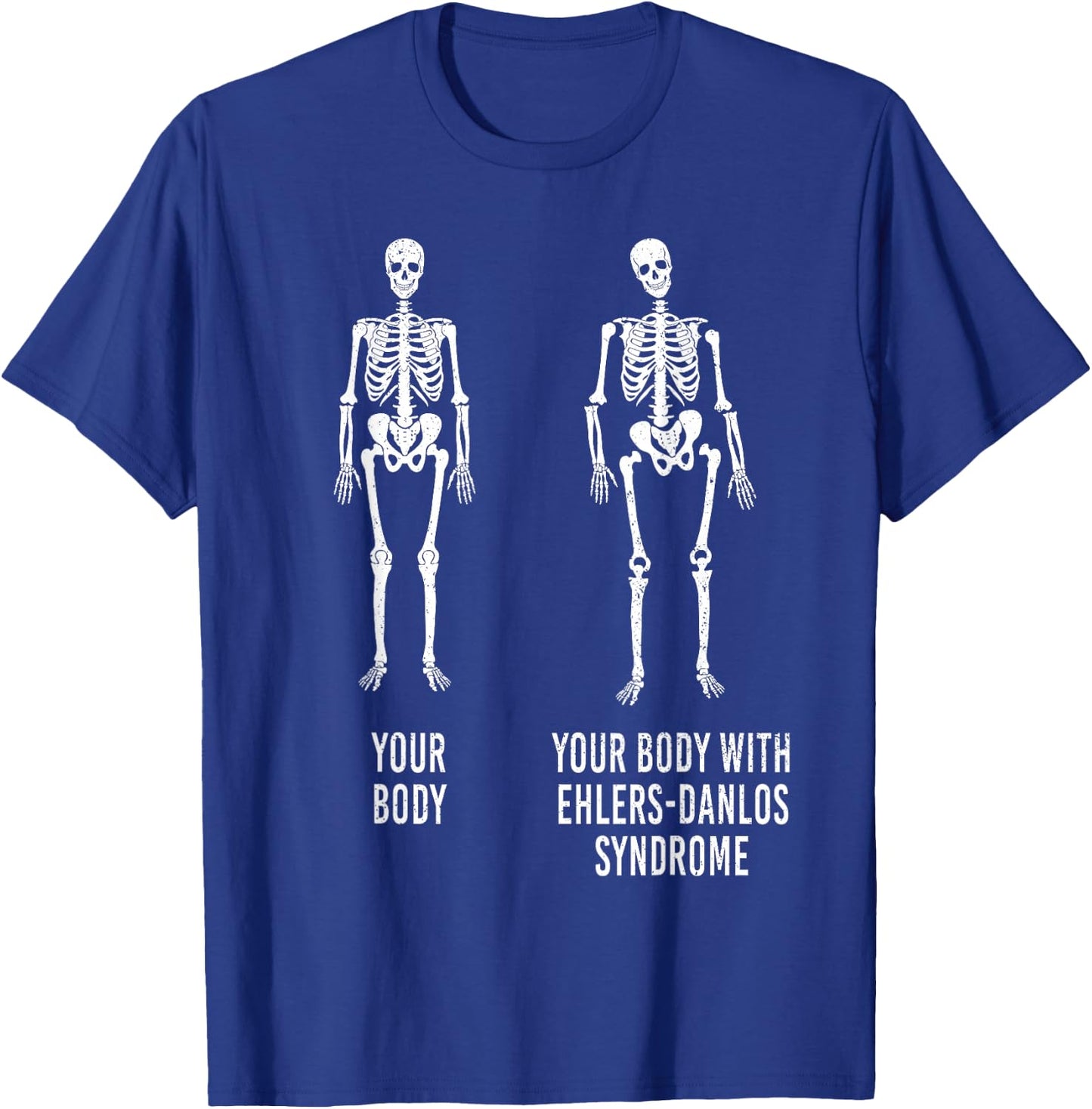Your Body with Ehlers-Danlos Syndrome EDS Support Awareness Small T-Shirt - T-Shirt | Royal