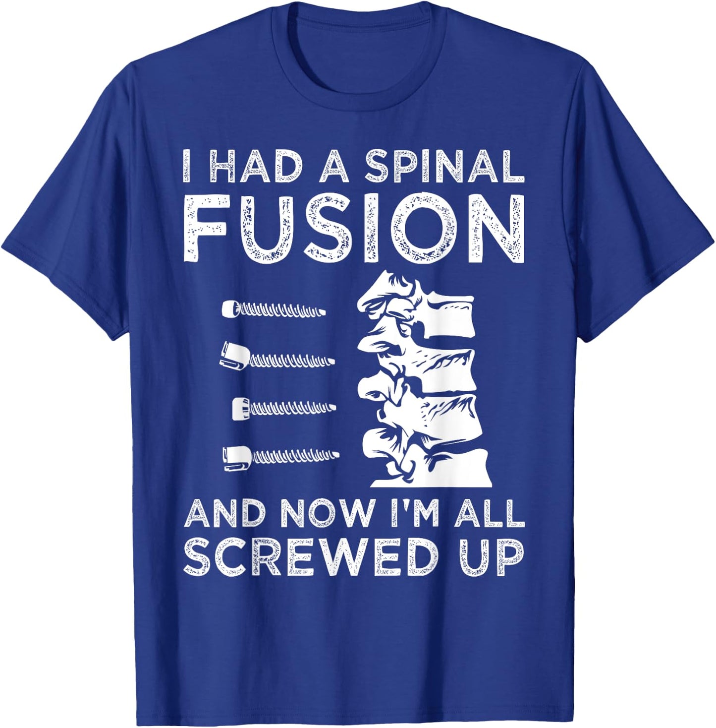 Cool Scoliosis Spinal Fusion Gift Back Surgery Recovery Gift T-Shirt - T-Shirt | Royal