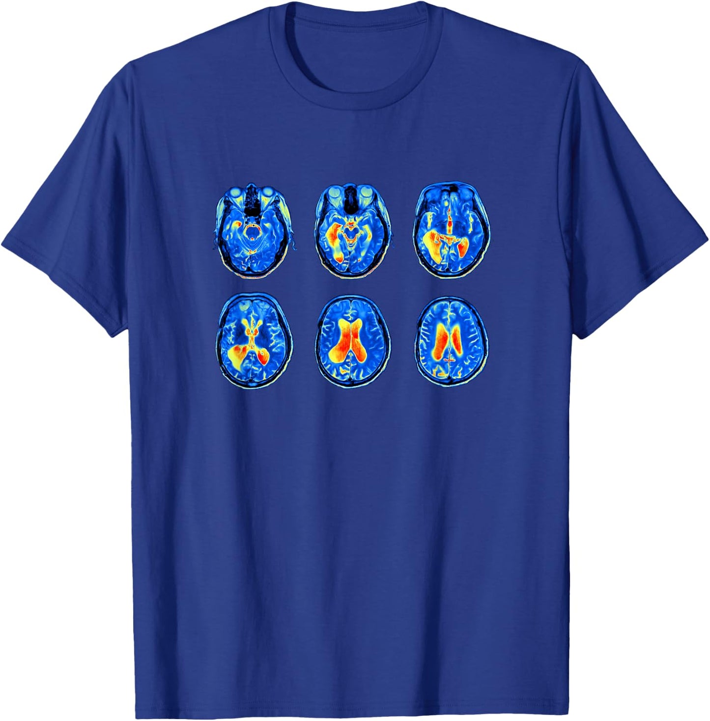Brain Scan MRI Images of Human Brain T-Shirt - T-Shirt | Royal