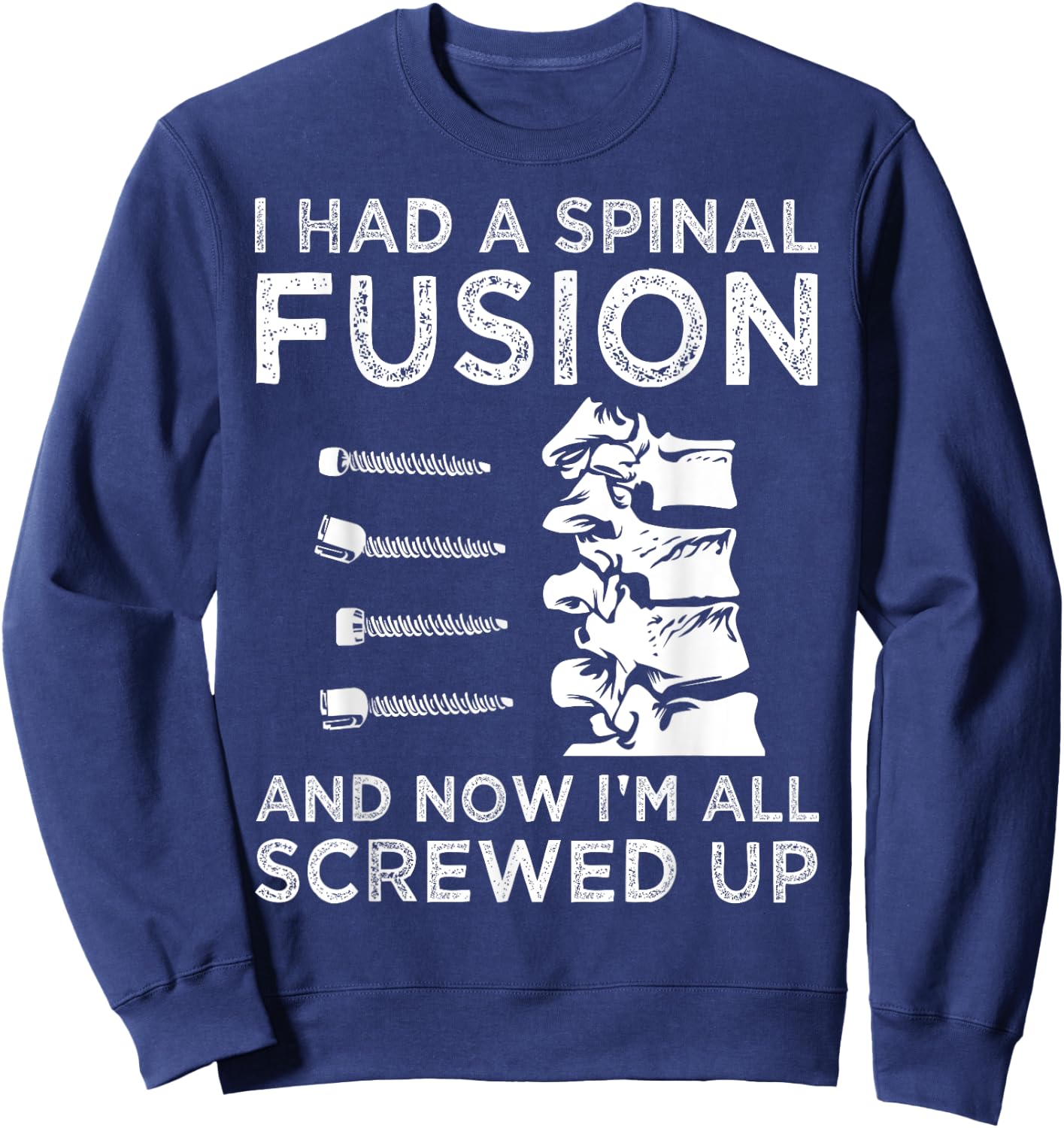 Cool Scoliosis Spinal Fusion Gift Back Surgery Recovery Gift Sweatshirt - Sweatshirt | Navy