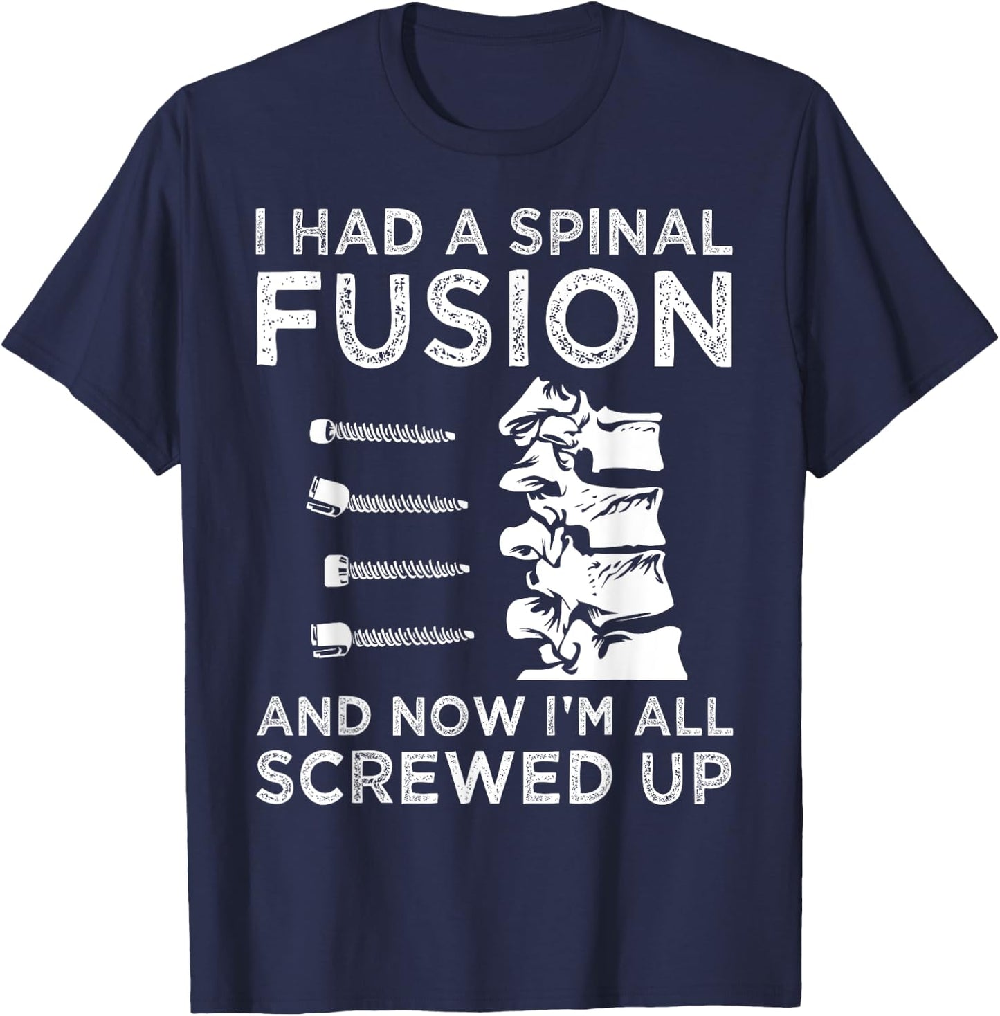 Cool Scoliosis Spinal Fusion Gift Back Surgery Recovery Gift T-Shirt - T-Shirt | Navy