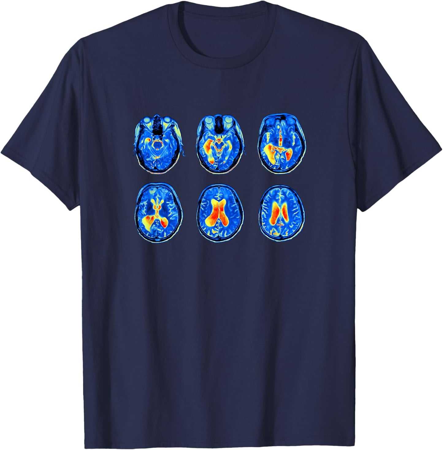 Brain Scan MRI Images of Human Brain T-Shirt - T-Shirt | Navy