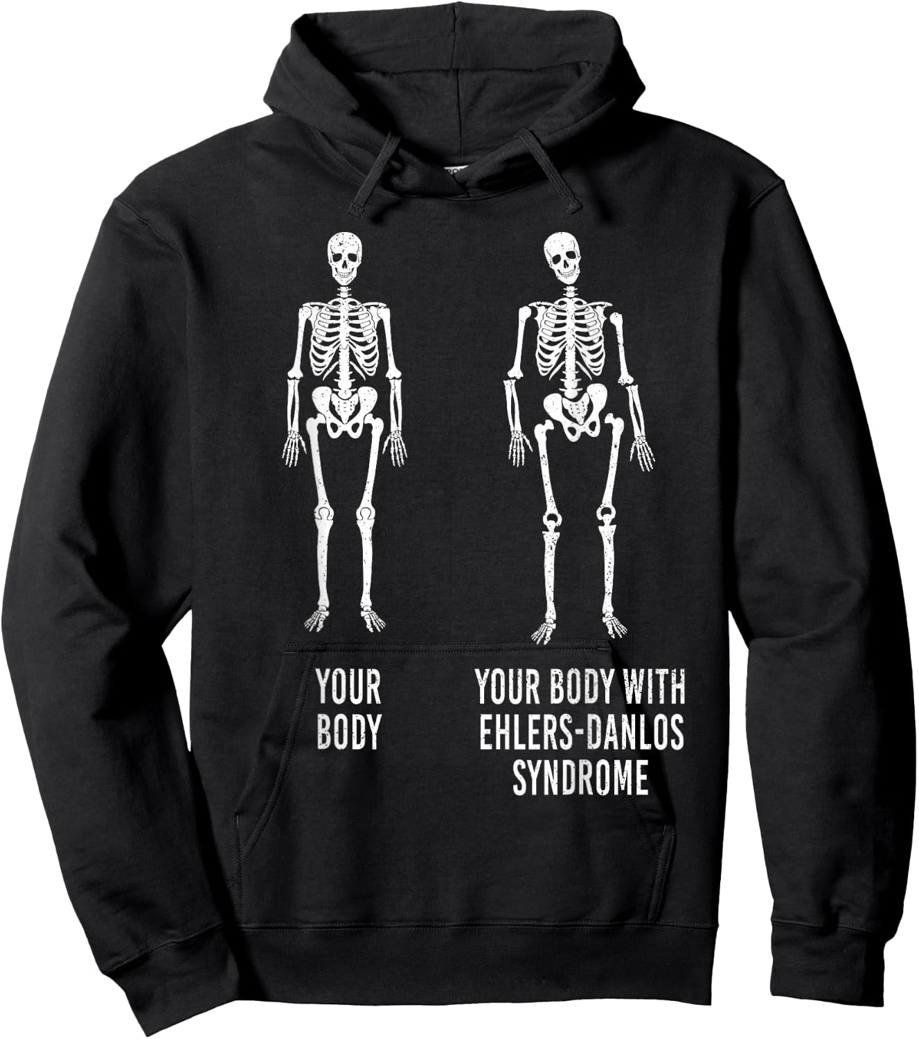 Your Body with Ehlers-Danlos Syndrome EDS Support Awareness Small Hoodie - Hoodie | Black
