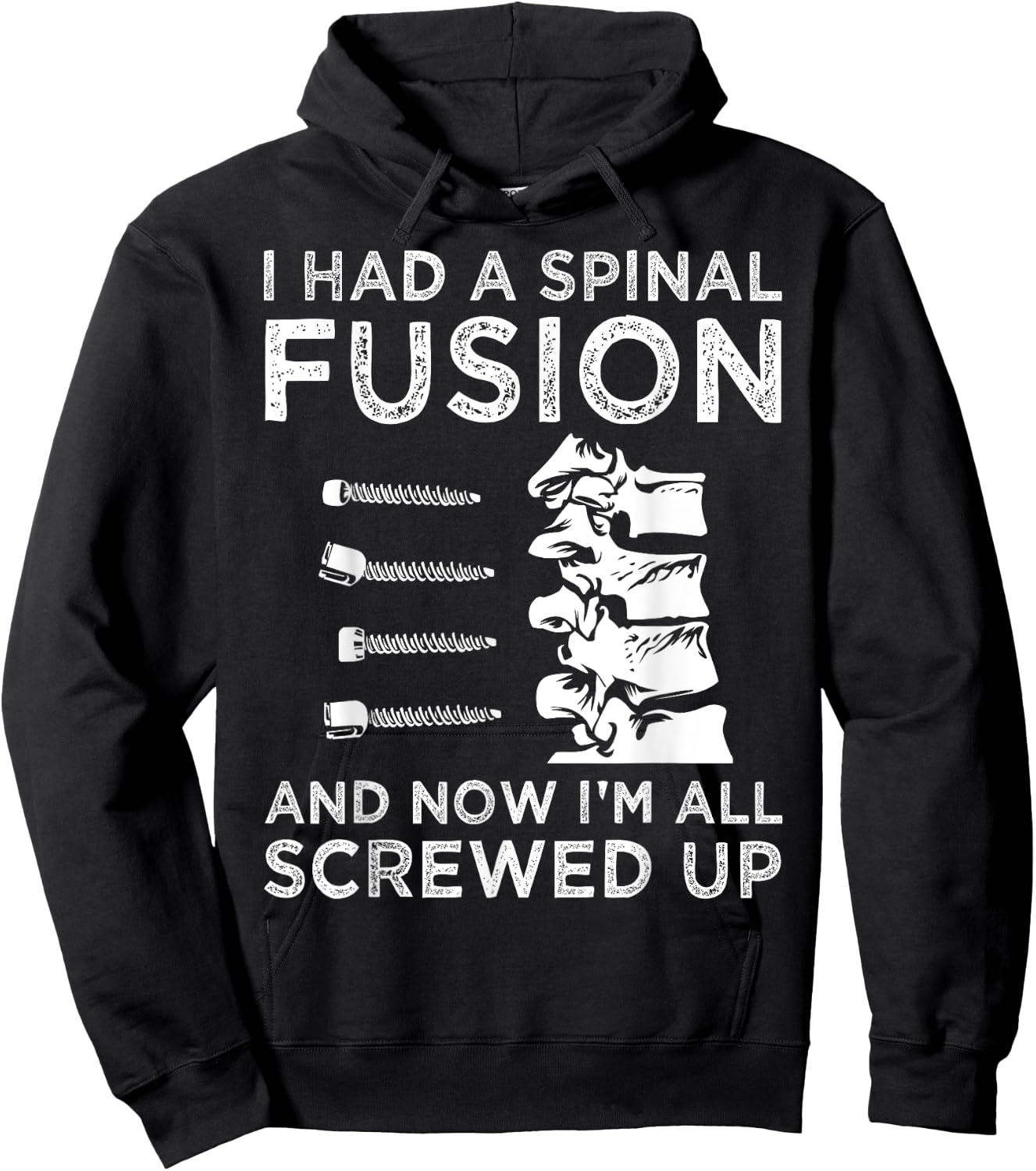 Cool Scoliosis Spinal Fusion Gift Back Surgery Recovery Gift Hoodie - Hoodie | Black