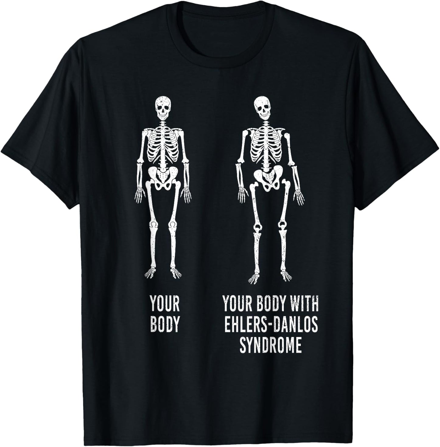Your Body with Ehlers-Danlos Syndrome EDS Support Awareness Small T-Shirt - T-Shirt | Black