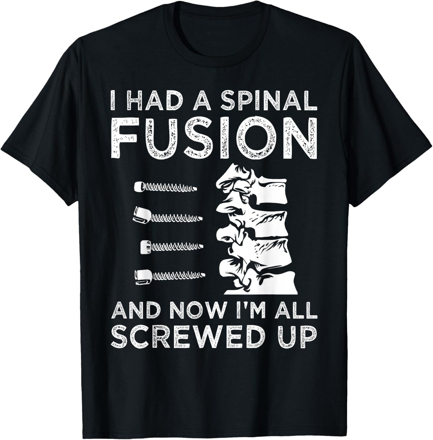 Cool Scoliosis Spinal Fusion Gift Back Surgery Recovery Gift T-Shirt - T-Shirt | Black