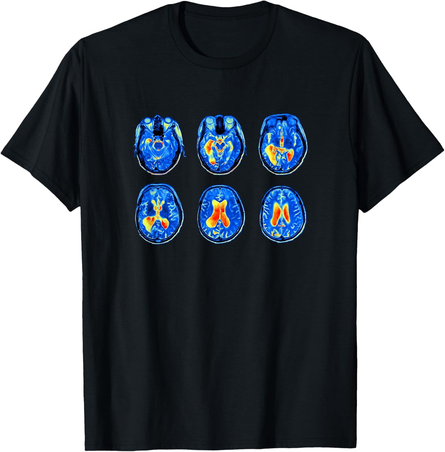 Brain Scan MRI Images of Human Brain T-Shirt - T-Shirt | Black